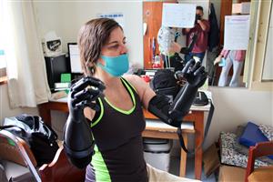 A woman wearing a mask practices using advanced prosthetic arms in a rehabilitation center. Her focused expression conveys resilience, independence, and the transformative power of assistive technology in improving lives and restoring confidence.