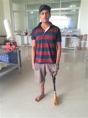 A man wearing a below-knee prosthetic. A boy wearing a below-knee prosthetic.